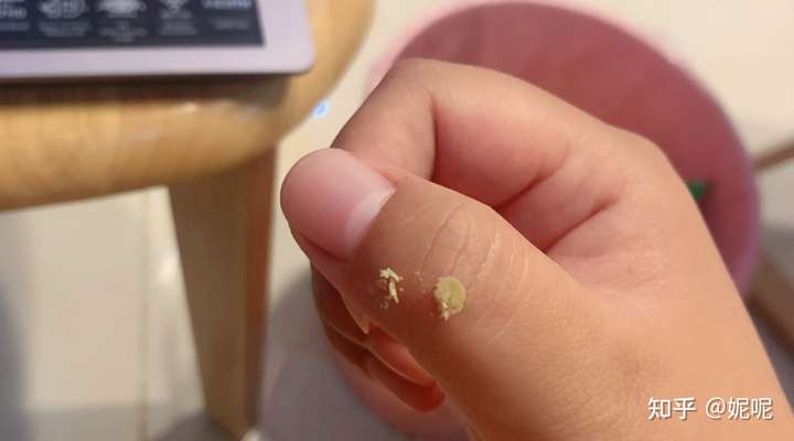 自己小的时候就狐臭了,我还是油耳,小的时候不懂… 还以为每个人耳屎