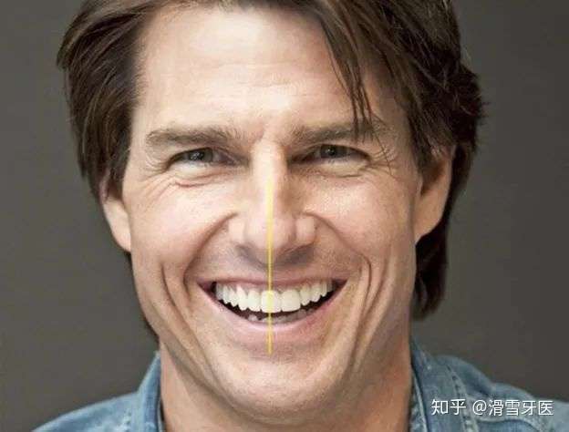 牙齿中线有多重要?