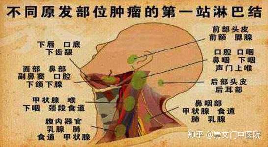 淋巴结肿大是怎么回事呢是什么引起的