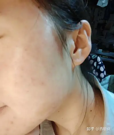 敏感肌适合使用的护肤品教你春敏快速修复皮肤屏障