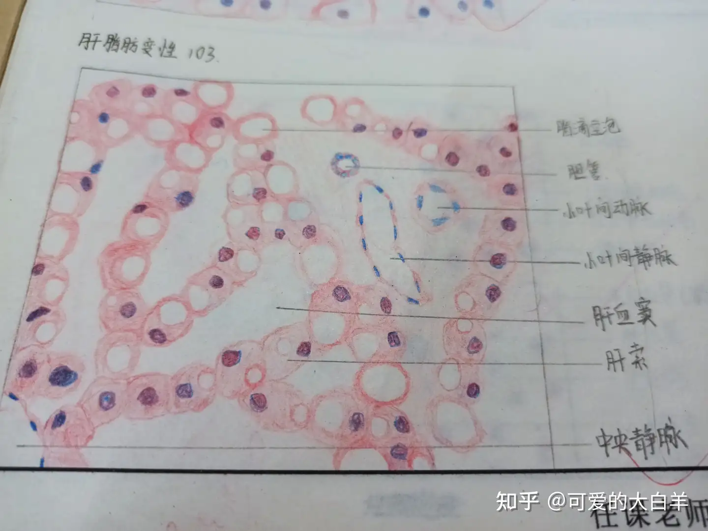 病理学红蓝铅笔图- 知乎