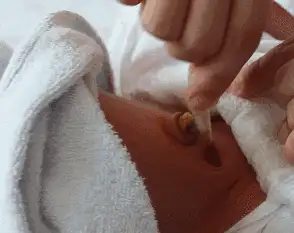 用碘伏棉签给新生儿肚脐消毒的正确步骤 - 知乎