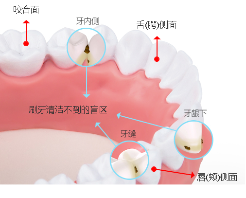 关于洁牙的3大误区，你中招了吗？