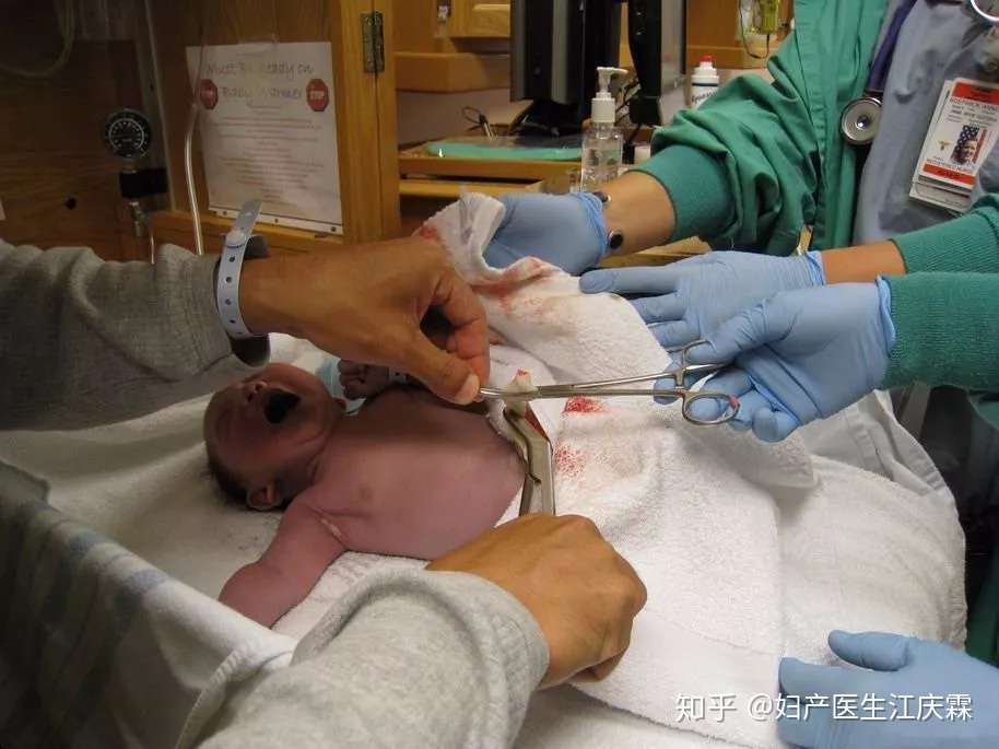 新生儿脐带消毒 脱落全过程 一张图教会你 知乎 新生儿脐带消毒 脱落全过程 一张图教会你 知乎