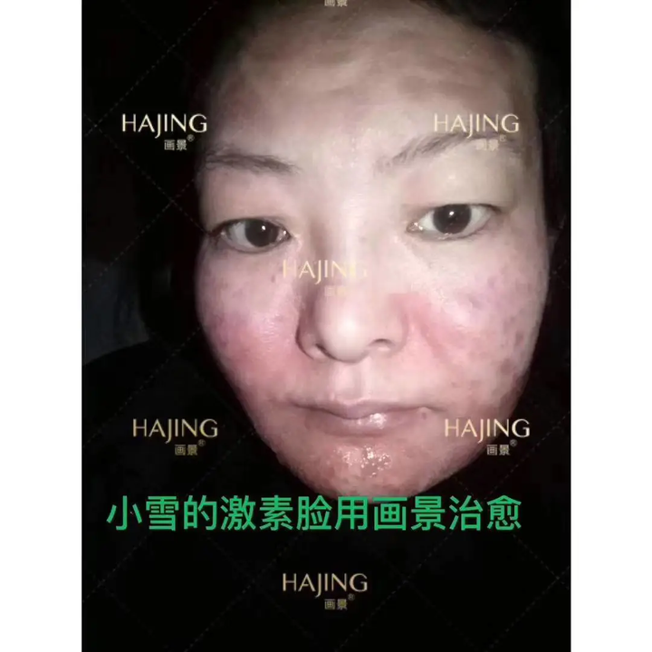 画景面膜效果好吗画景面膜真心好用吗