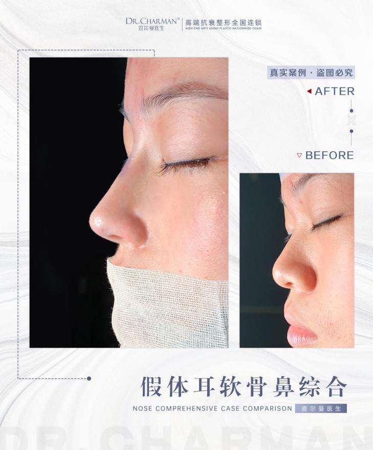 大海物語 鼻形成術 Rebuilding Nose 裁断済 本・音楽・ゲーム