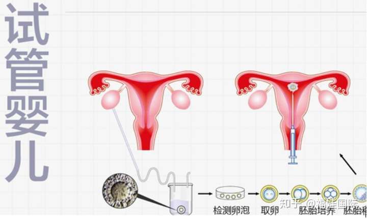 著床成功率高不是謠言囊胚培養的這4大優勢你知道嗎