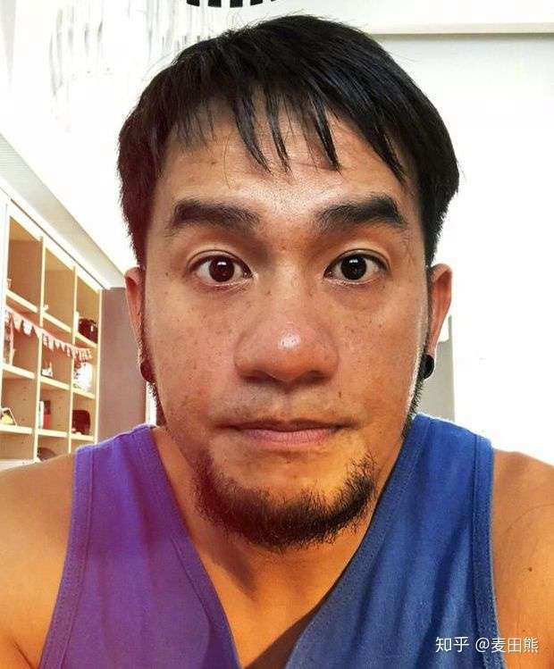 这些明星都没能逃掉蒜头鼻的制裁 真的这么毁颜值吗 知乎