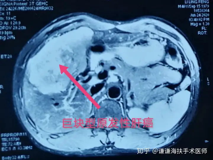 石至长衬系拿山京区煞垛屈阀