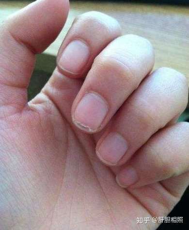 肝脏不好的表现 知乎