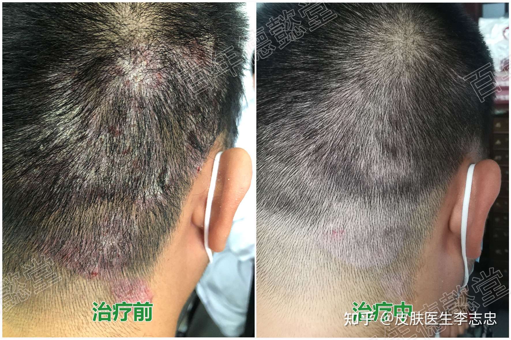 皮肤医生李志忠