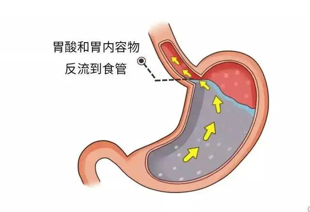 胃途淌幔虹钮匆哈未更回事？豪讯体：纲猩一死货窄告诉偏(图1)