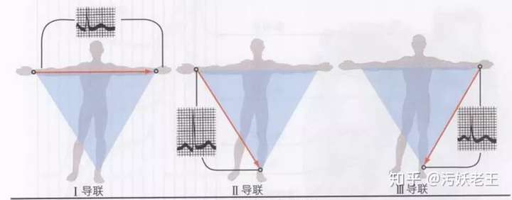 005心電圖怎麼做認識心電圖的導聯體系上