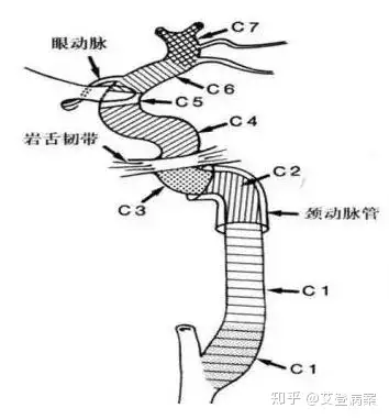 pokpo虹吸器解剖图图片