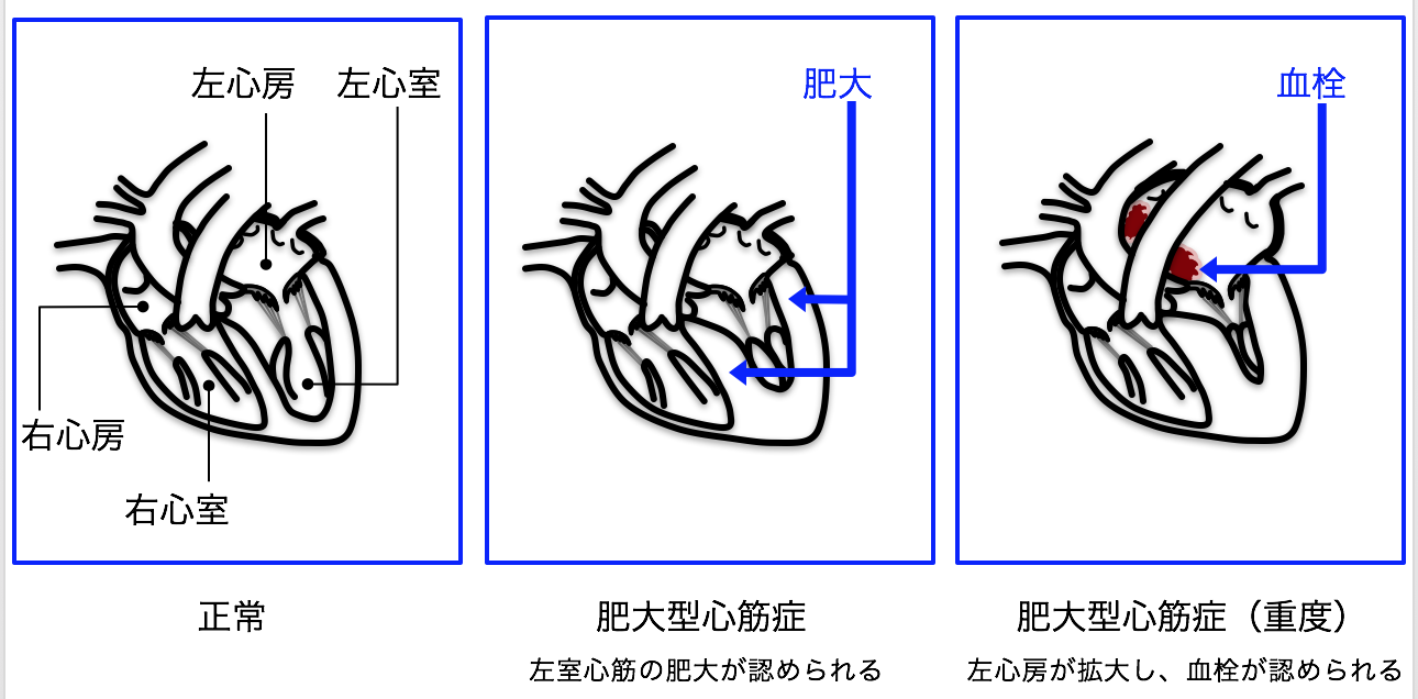 猫咪后肢无力瘫痪僵硬发凉，走不动路的病因分析之猫血栓- 知乎