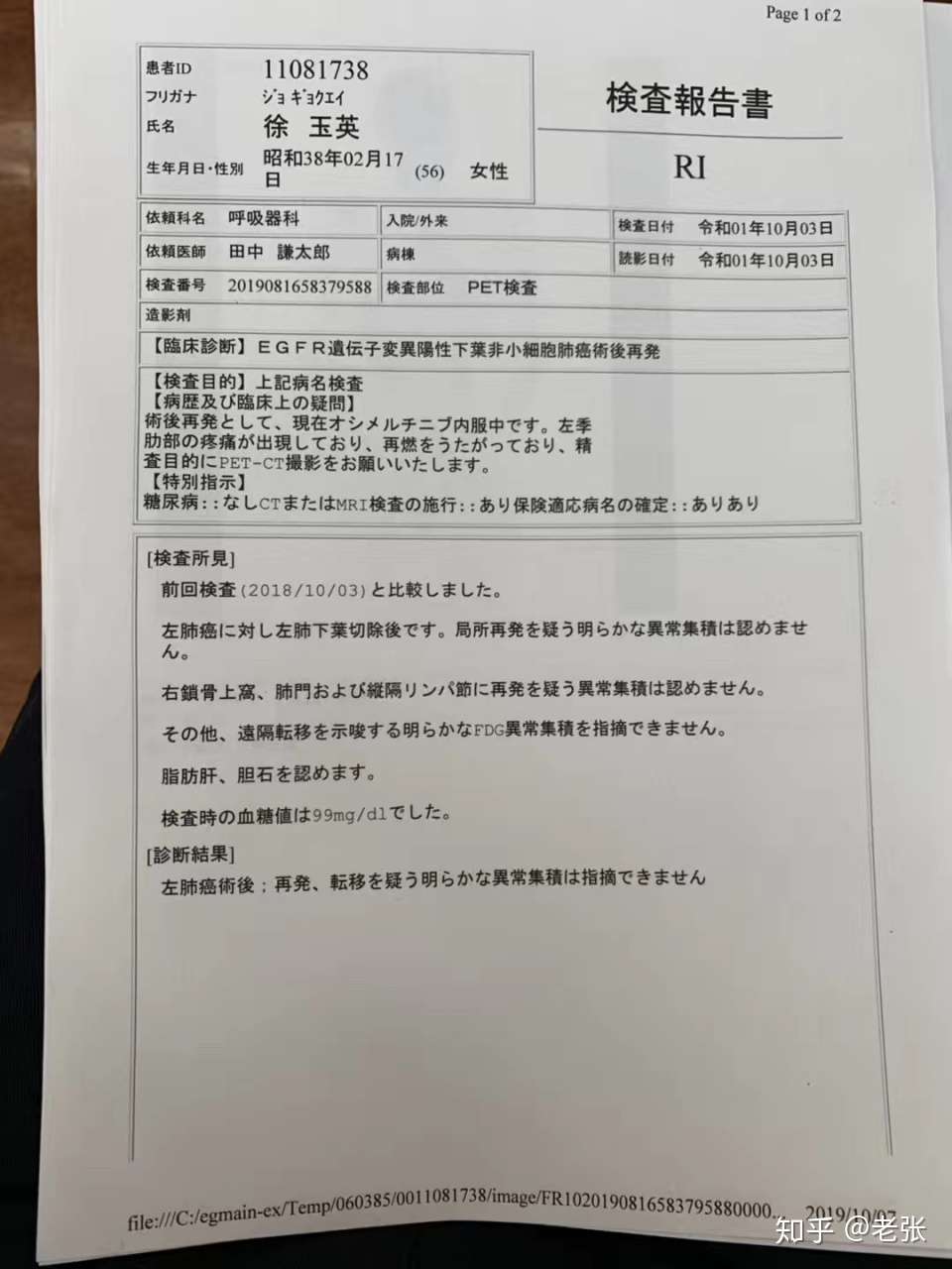 她经过10个月的抗癌治疗 13处转移的肿瘤消失了 知乎