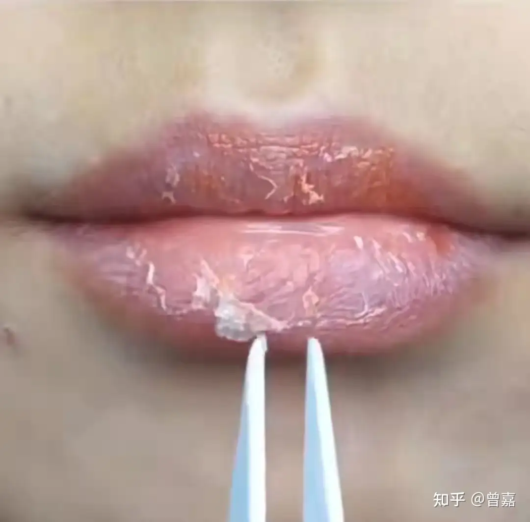 D1sdvdkoekfesm D1sdvdkoekfesm