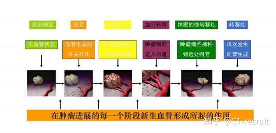 抗血管生成药物是治疗晚期肿瘤的万金油吗
