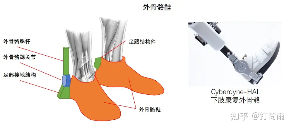 外骨骼绑缚——不可或缺的人机物理接口- 知乎