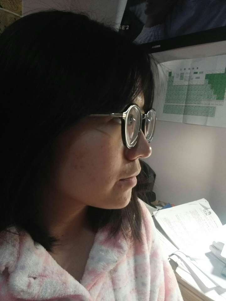 戴眼镜会使鼻梁变塌吗.