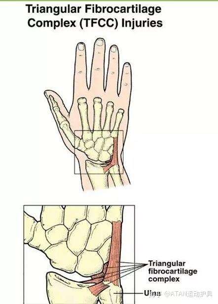 手腕损伤的自我诊断 知乎