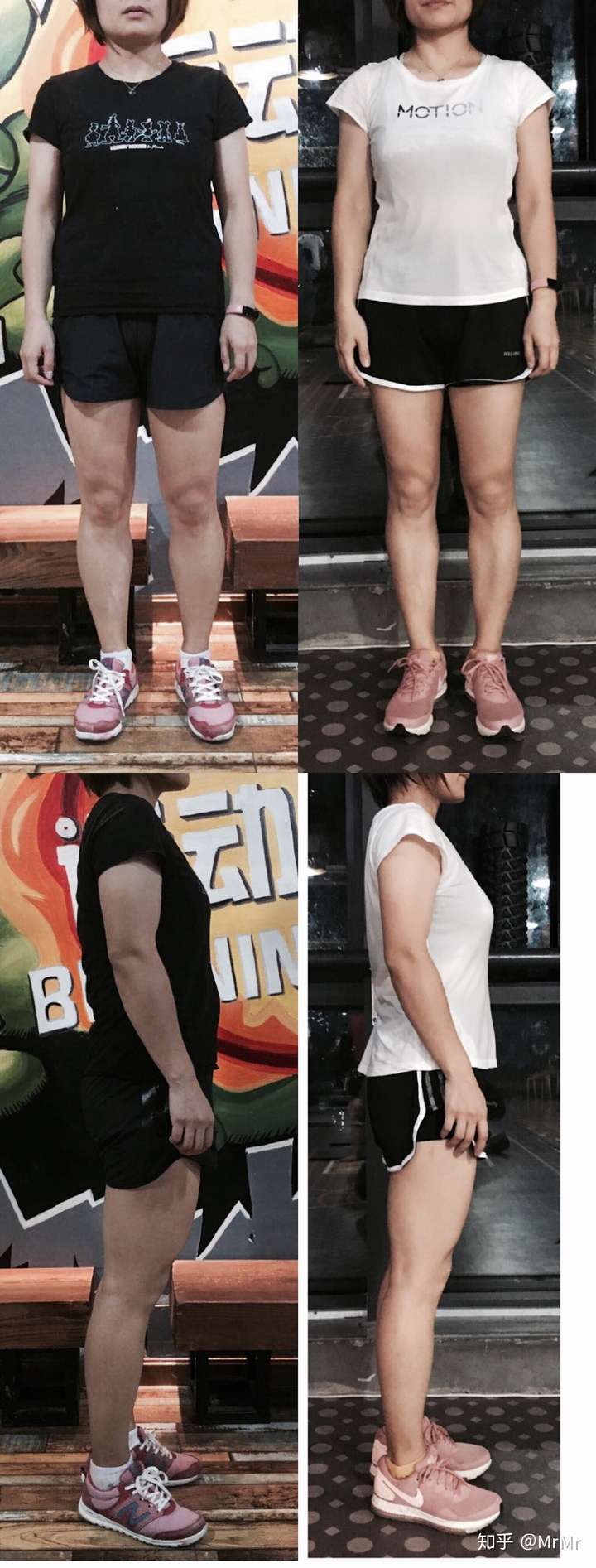她的问题是生完孩子肚子很大 肌肉腿 驼背 含胸 身体前倾(抱孩子抱的