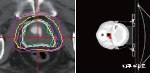 人工智能(AI)应用案例 人工智能(AI)应用案例