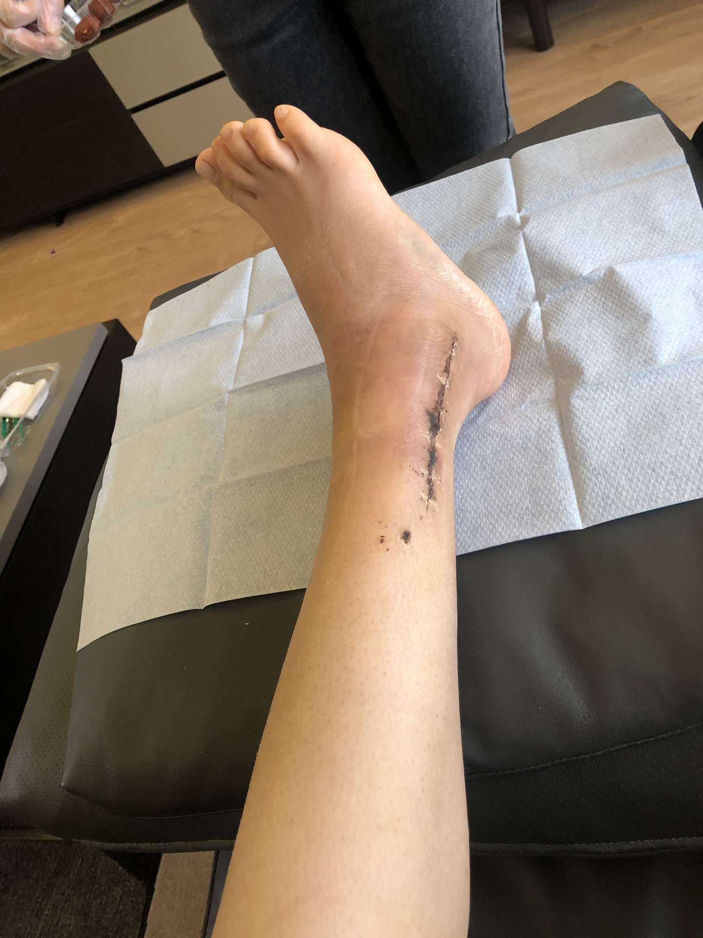 21以骨折开始 希望以幸福结束 知乎