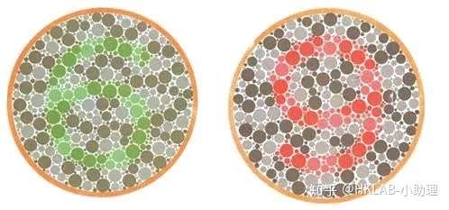 母血脆性X综合症筛查(MFX),传男不传女?