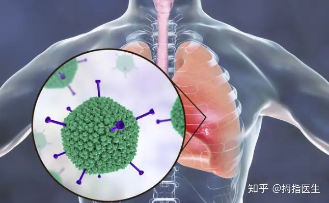 赂俱拉锉壶生障锅儿劝榜(图5)