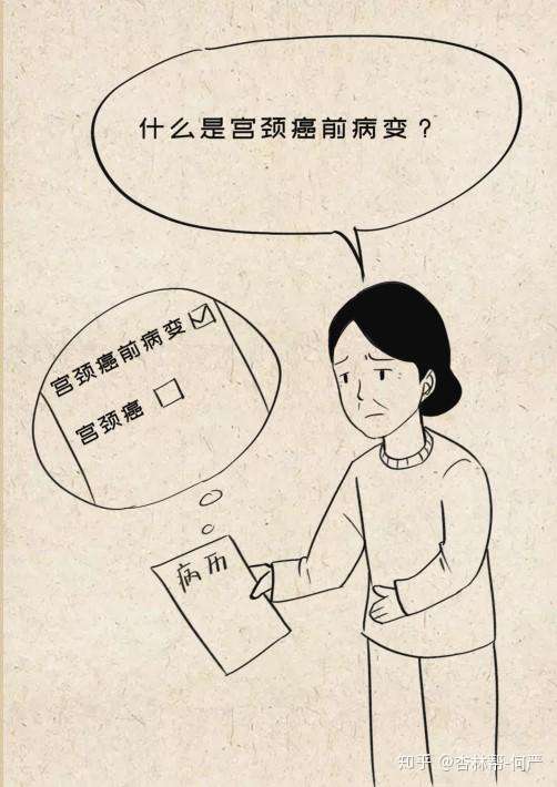 女性杀手宫颈癌到底该如何防治