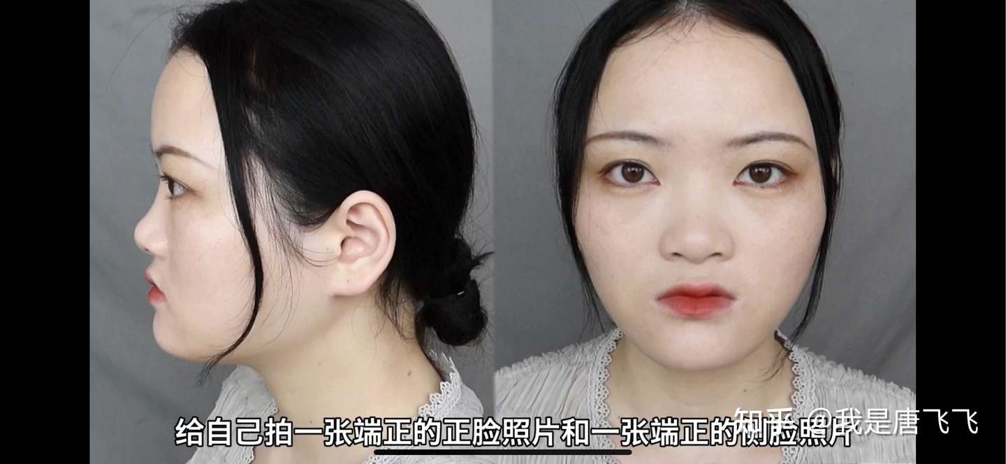 颜值分析 如何拯救一个极丑的鼻子 鼻整形必看 知乎