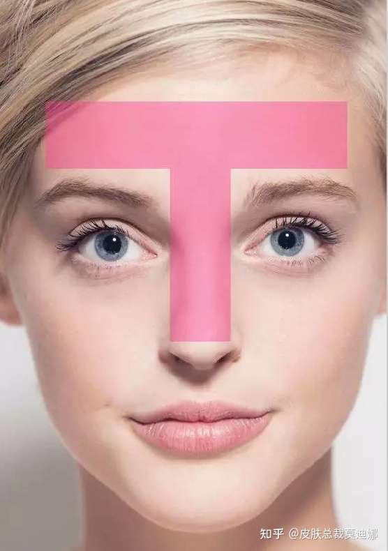 鼻翼油 脸颊不油不紧绷 但起皮是什么肤质?