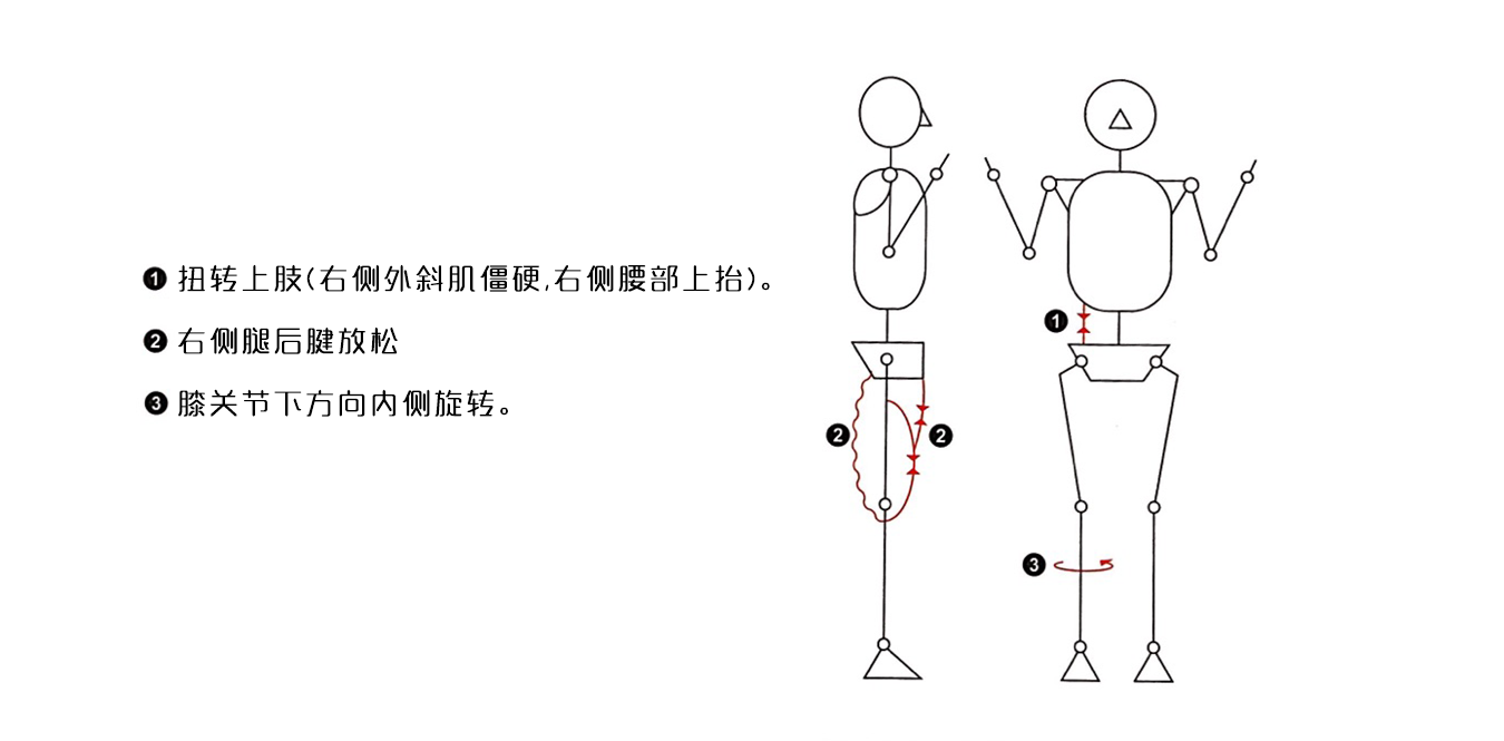 如何改善胫前疼痛 知乎