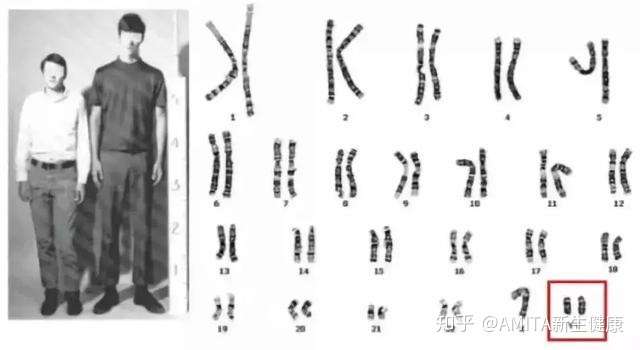 Xxy Or Xyy 带你走进真实的 第三性别 群体 知乎