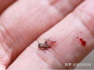 蚊子你在耳边嗡嗡嗡,这时你屏住呼吸,手起刀落,一巴掌把蚊子拍在自己