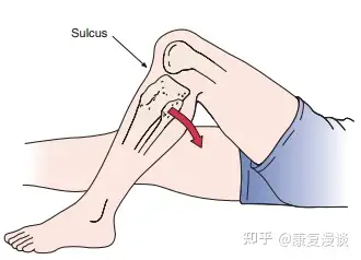 前抽屉试验anterior drawer test前抽屉试验常用于前交叉韧带损伤