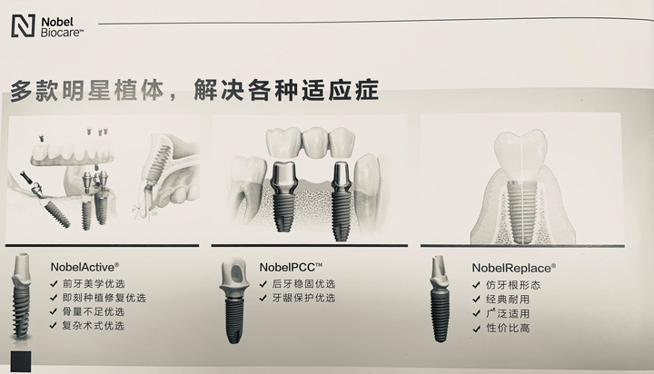 种植牙多少钱一颗2022,种植牙多少钱一颗(图3)