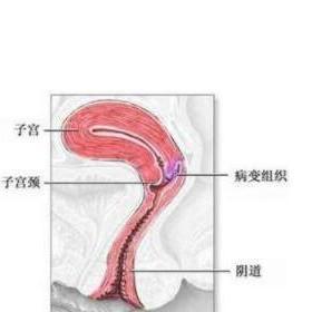 宫颈口正常的图片图片