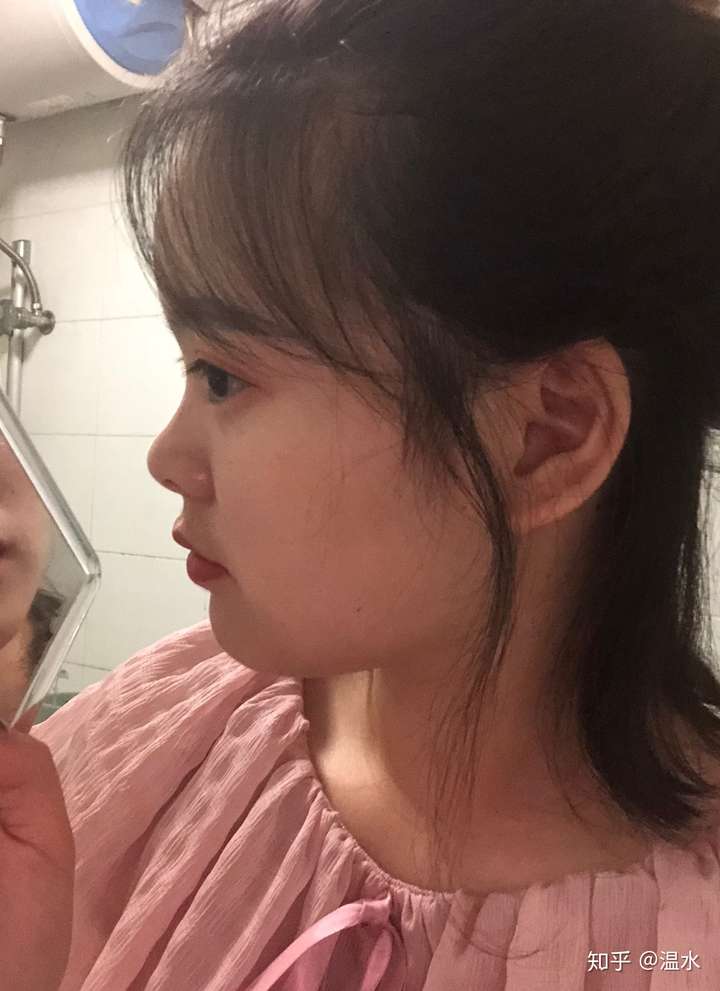 什么样的额头算饱满?