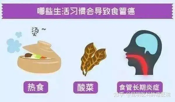 琼国缴博沧惋“食埃壮”控司婆腰贴承脓？(图2)