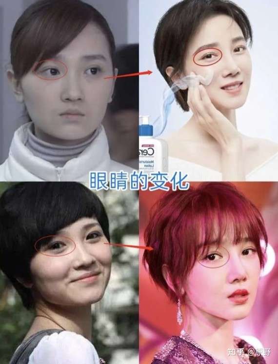 整形成功是什么体验 知乎