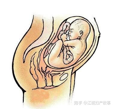 胎动异常 胎心停止 胎儿缺氧的4大症状必须了解 知乎
