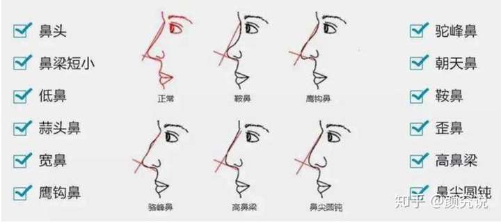 怎样才算塌鼻梁?