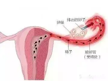 为什么做完输卵管通水后仍未怀孕