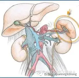 招飞体检常见异常:副脾和脾脏增大 - 知乎