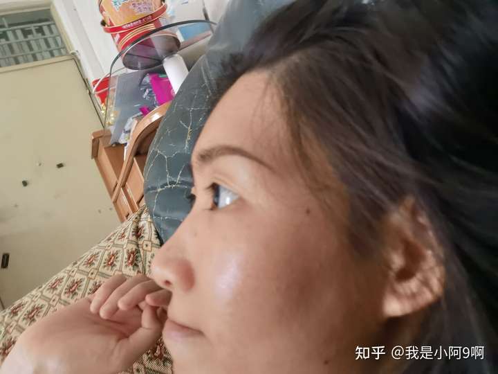 没有鼻梁,鼻子塌的人是什么体验?