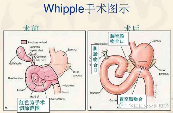 为什么有的人喜欢半英文半中文讲话?