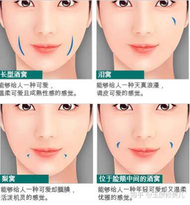 我这个是酒窝还是梨窝还是什么都不是啊? - 知乎