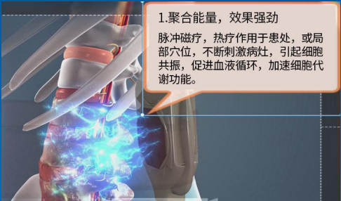 铁腰板治腰突